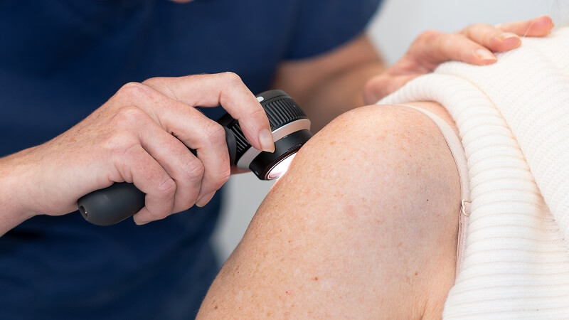 How to Choose the Right Skin Cancer Specialist in NSW