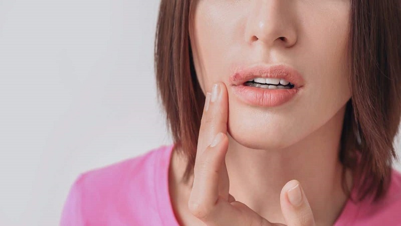 Why “Meth Sores” Are More Than Just a Cosmetic Problem