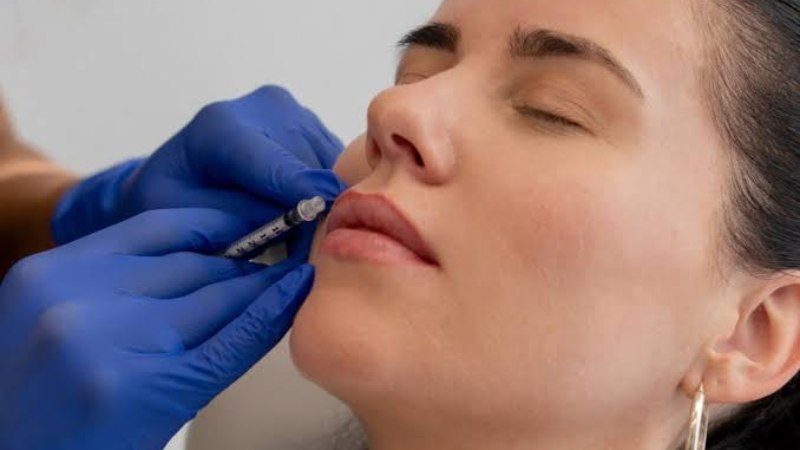 dermal fillers in Cincinnati